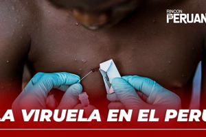 La viruela en el Perú